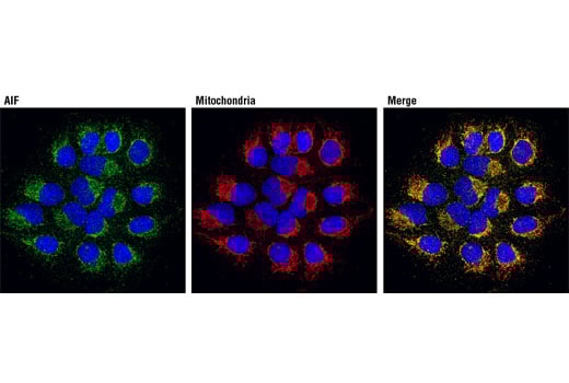 Immunofluorescence Image 1: SMG-1 (V72) Antibody