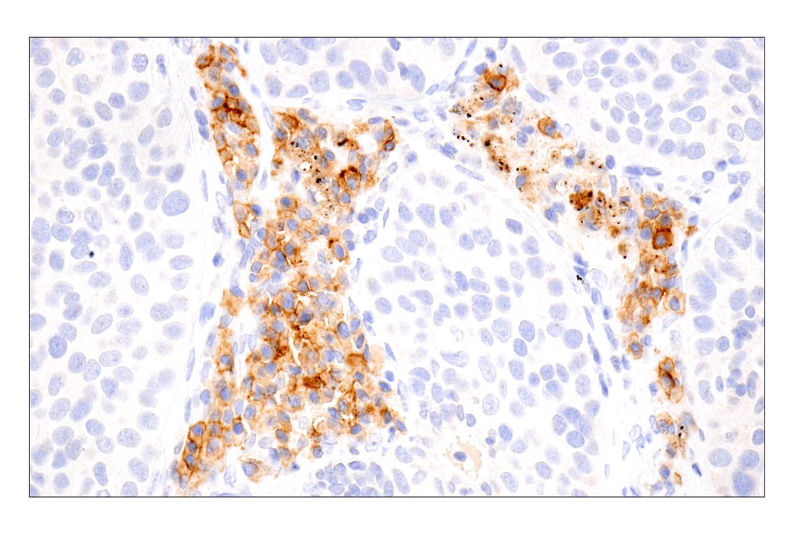 Immunohistochemistry Image 5: TNFRSF17/BCMA (E6D7B) Rabbit Monoclonal Antibody