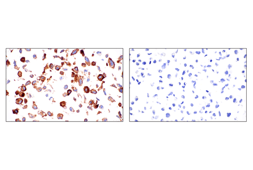 Immunohistochemistry Image 6: CD10/Neprilysin (E5P7S) Rabbit Monoclonal Antibody (BSA and Azide Free)