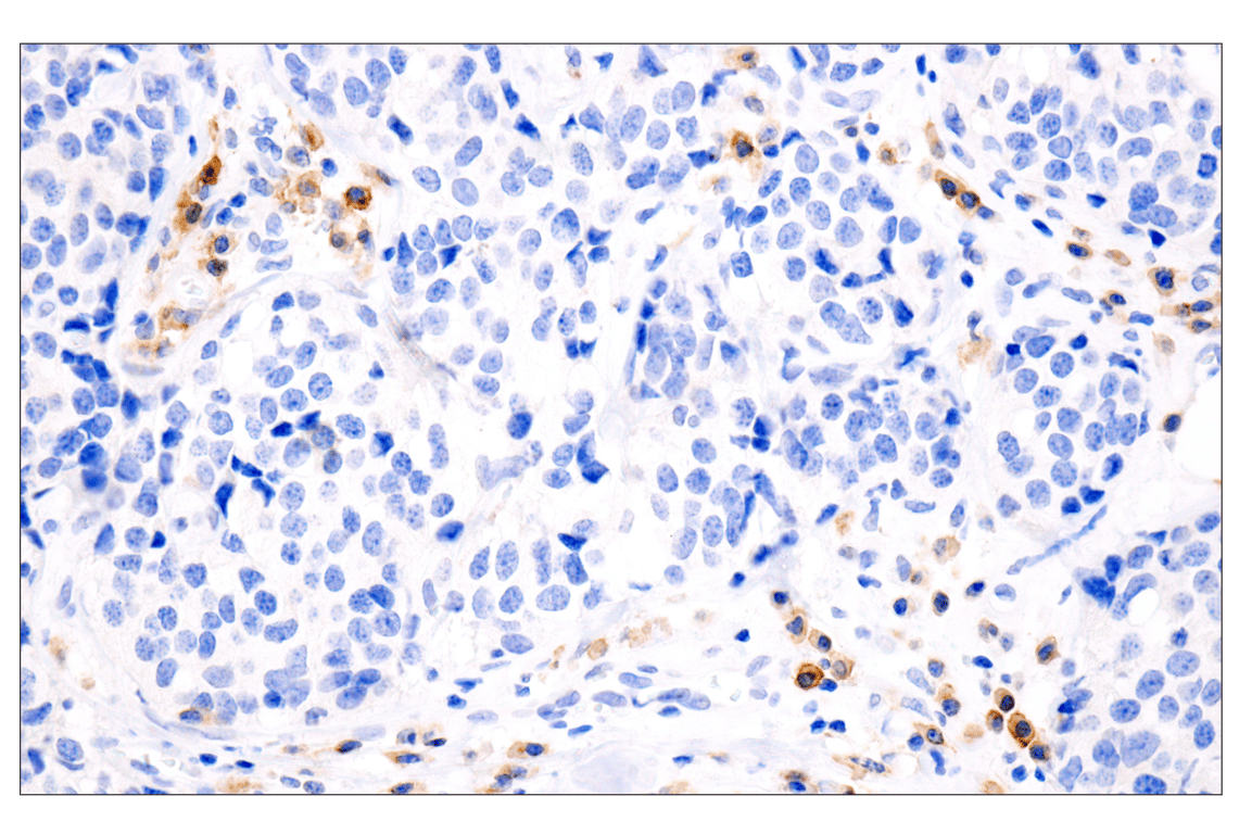 Immunohistochemistry Image 3: TNFRSF17/BCMA (E6D7B) Rabbit Monoclonal Antibody