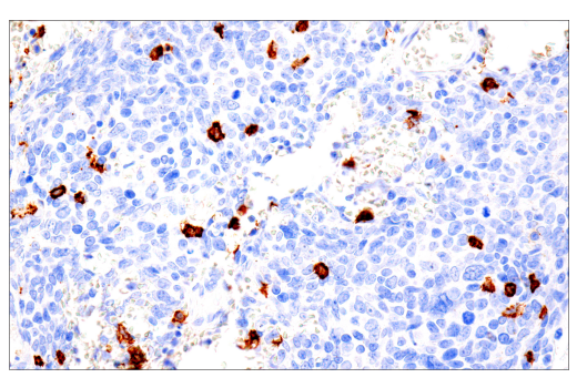 Immunohistochemistry Image 2: CD20 (L26) Mouse Monoclonal Antibody