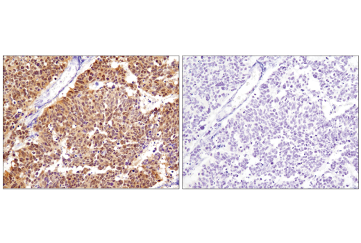 Immunohistochemistry Image 2: CDK4 (D9G3E) Rabbit Monoclonal Antibody (BSA and Azide Free)