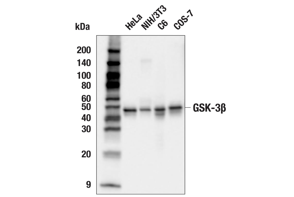 Western Blotting Image 2: GSK-3 beta (D5C5Z) Rabbit Monoclonal Antibody