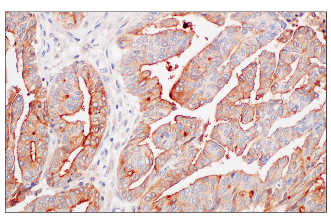 Immunohistochemistry Image 3: LY6E (F8Y1R) Rabbit Monoclonal Antibody