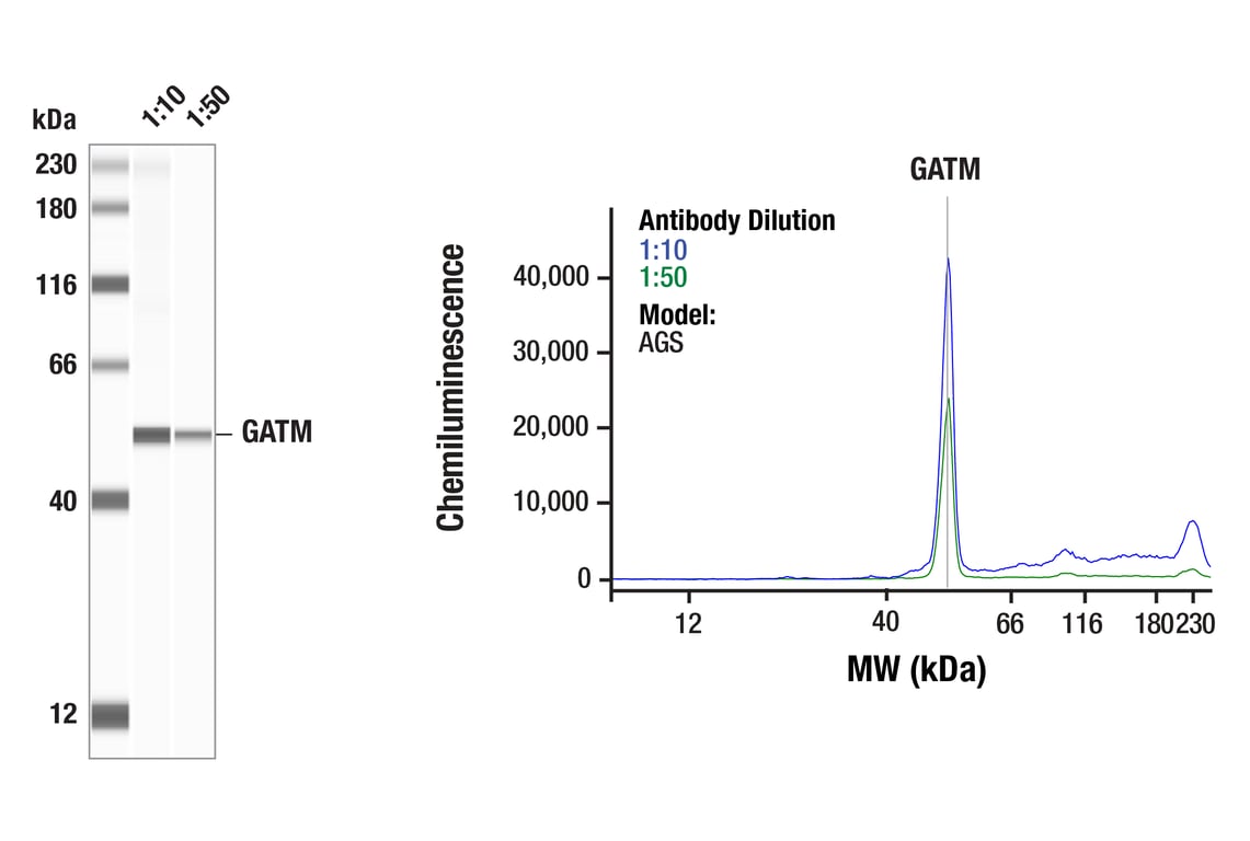 Western Blotting Image 1: GATM (F6S8W) Rabbit Monoclonal Antibody