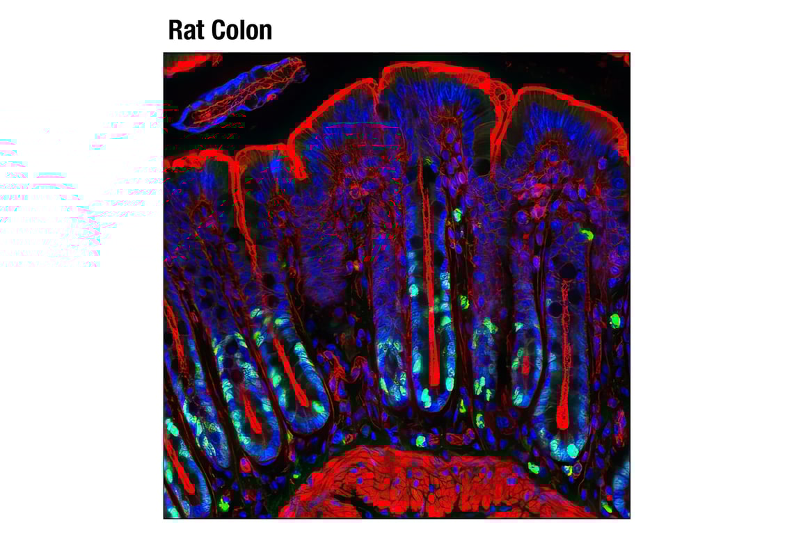 Immunofluorescence Image 1: Ki-67 (D3B5) Rabbit Monoclonal Antibody (Alexa Fluor<sup>®</sup> 488 Conjugate)