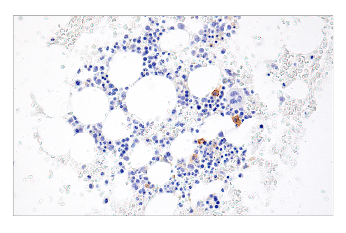 Immunohistochemistry Image 1: TNFRSF17/BCMA (E6D7B) Rabbit Monoclonal Antibody