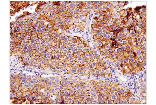 Immunohistochemistry Image 1: B7-H3 (D9M2L) Rabbit Monoclonal Antibody