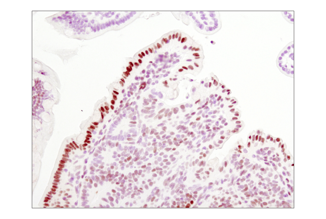 Immunohistochemistry Image 1: Phospho-Stat3 (Tyr705) (D3A7) XP<sup>®</sup> Rabbit mAb (BSA and Azide Free)