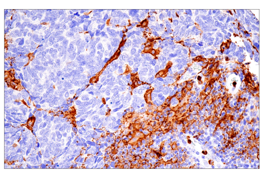Immunohistochemistry Image 2: FcR gamma (E6Y1A) Rabbit Monoclonal Antibody (BSA and Azide Free)