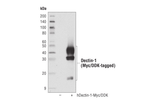 Western Blotting Image 2: Dectin-1/Clec7a (E1X3Z) Rabbit Monoclonal Antibody
