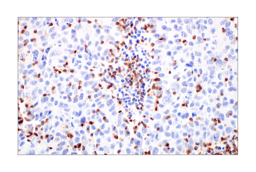 Immunohistochemistry Image 4: CD2 (D6V9F) Rabbit Monoclonal Antibody