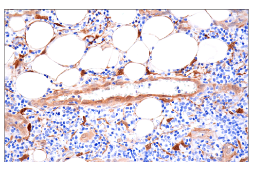 Immunohistochemistry Image 5: NNMT (E6N2Z) Rabbit Monoclonal Antibody