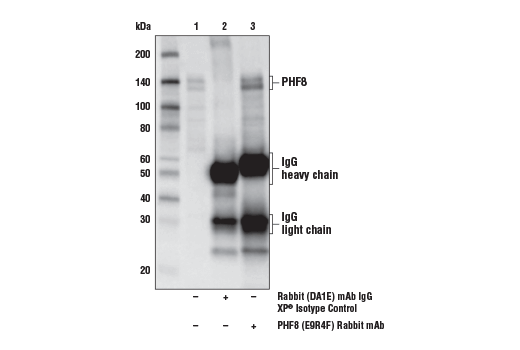 Immunoprecipitation Image 1: PHF8 (E9R4F) Rabbit Monoclonal Antibody