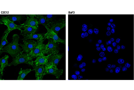 Immunofluorescence Image 1: CD81 (D5O2Q) Rabbit Monoclonal Antibody (BSA and Azide Free)
