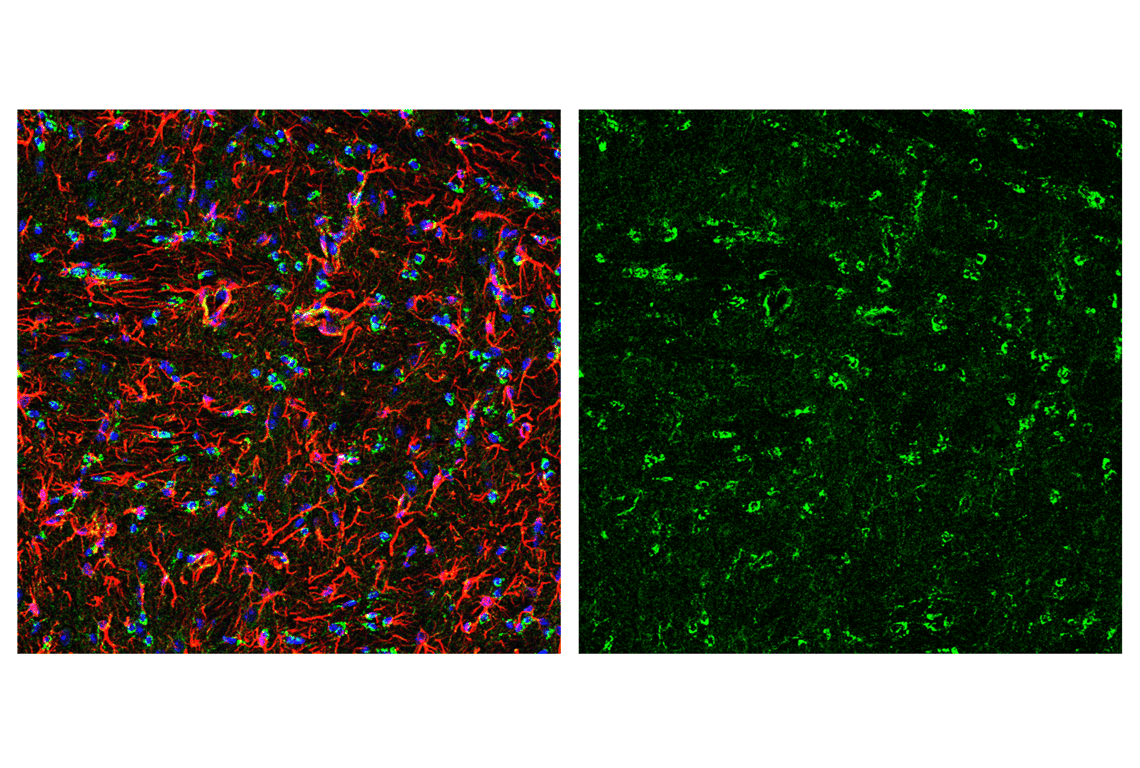 Immunofluorescence Image 5: Smac/Diablo (D5S3R) Rabbit Monoclonal Antibody