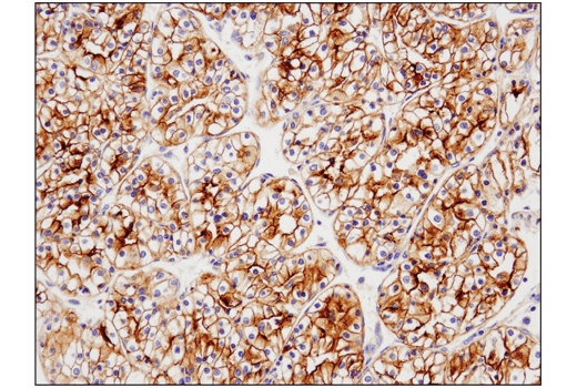 Immunohistochemistry Image 1: TIM-3 (D5D5R<sup>™</sup>) Rabbit Monoclonal Antibody