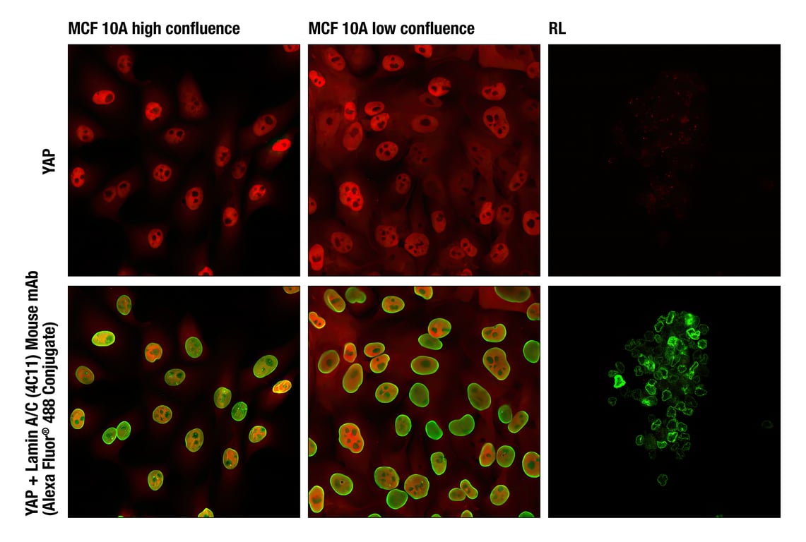 Immunofluorescence Image 1: YAP (D8H1X) Rabbit Monoclonal Antibody (Alexa Fluor<sup>®</sup> 647 Conjugate)