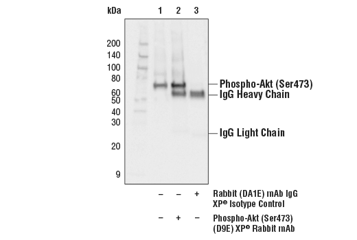 Immunoprecipitation Image 1: Phospho-Akt (Ser473) (D9E) Rabbit Monoclonal Antibody