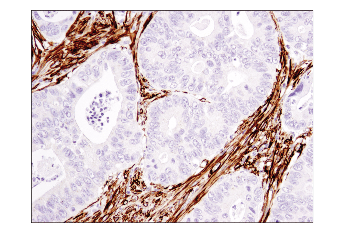 Immunohistochemistry Image 3: alpha-Smooth Muscle Actin (1A4) Mouse Monoclonal Antibody (BSA and Azide Free)