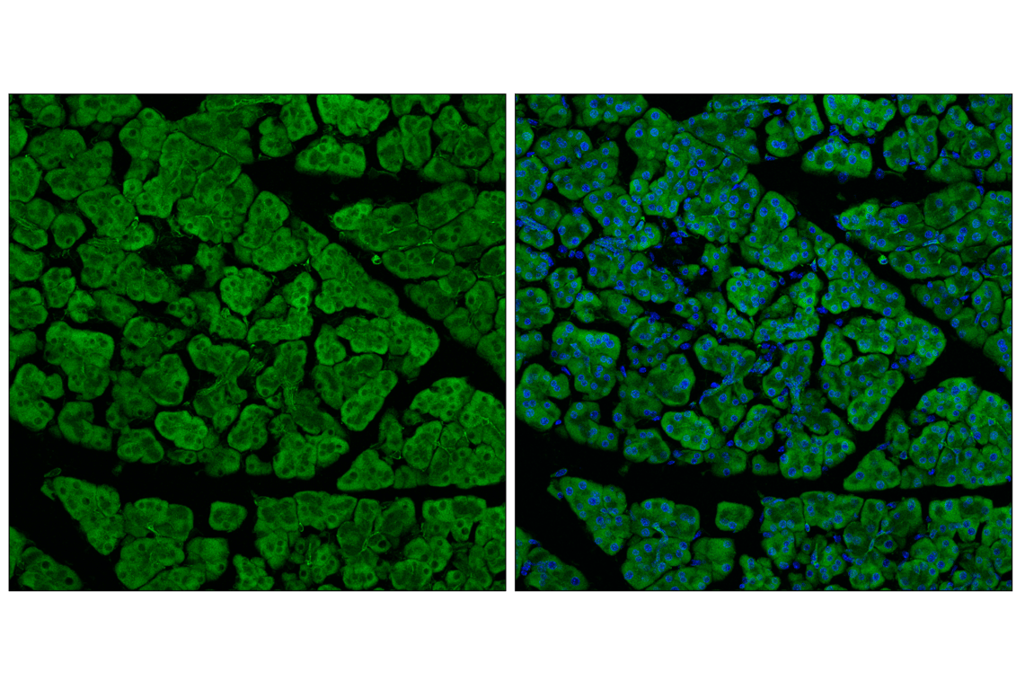 Immunofluorescence Image 1: POR (F6Y3C) Rabbit Monoclonal Antibody
