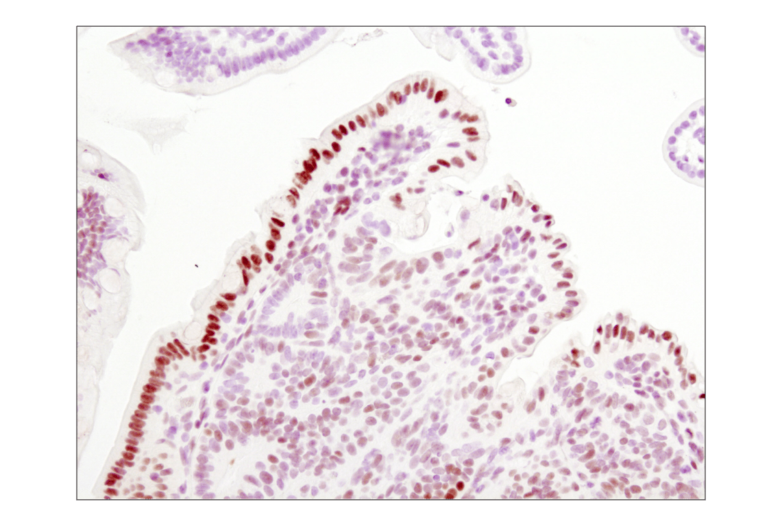 Immunohistochemistry Image 1: Phospho-Stat3 (Tyr705) (D3A7) Rabbit Monoclonal Antibody