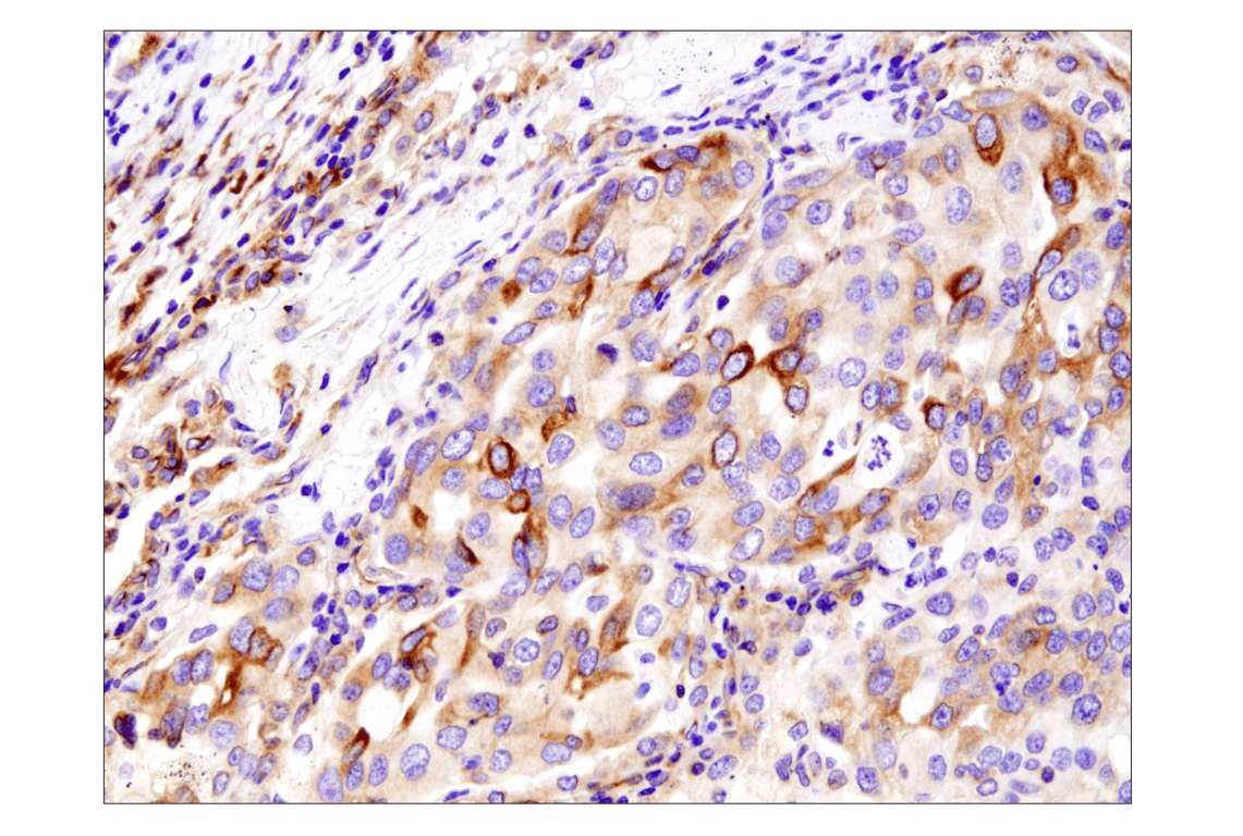 Immunohistochemistry Image 2: beta-Tubulin (D3U1W) Mouse Monoclonal Antibody