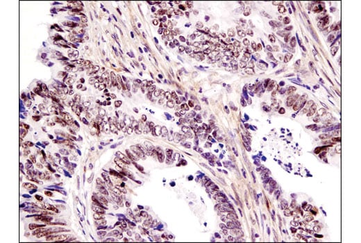 undefined Image 11: PBAF Complex Antibody Sampler Kit