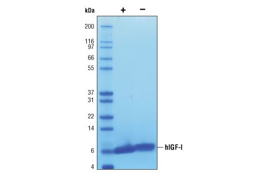 undefined Image 2: Human Insulin-like Growth Factor I (hIGF-I)