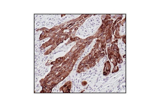 Immunohistochemistry Image 5: Pan-Keratin (C11) Mouse Monoclonal Antibody