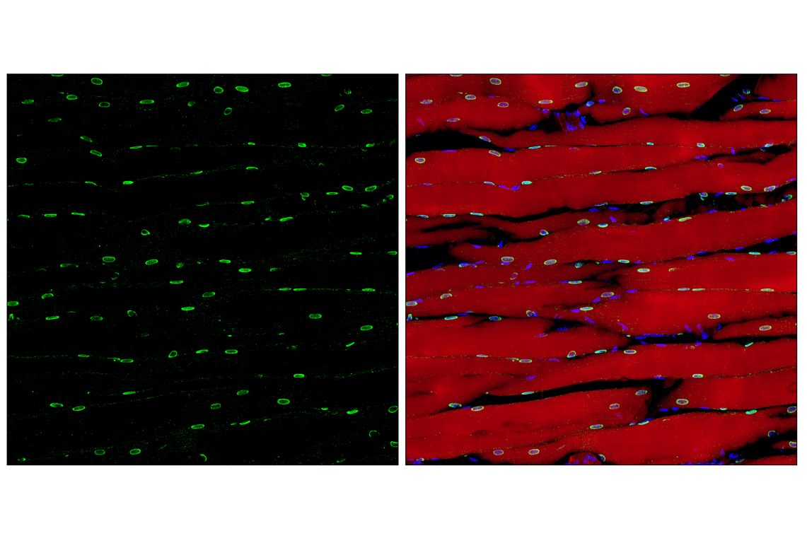 Immunofluorescence Image 3: PCM-1 (F8Q8B) Rabbit Monoclonal Antibody