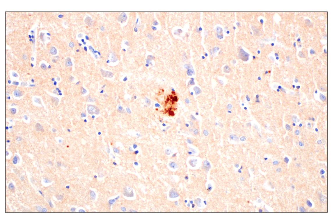 Immunohistochemistry Image 3: BACE1 (F4Z7X) Rabbit Monoclonal Antibody