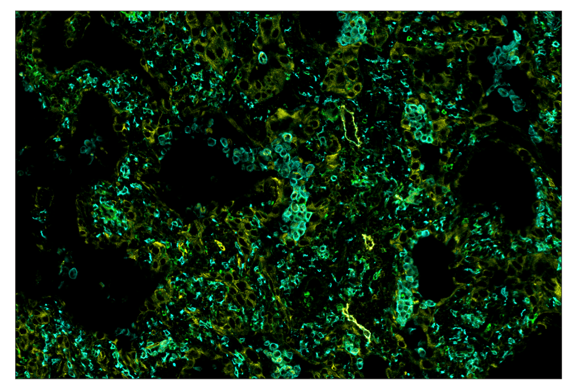 Immunohistochemistry Image 7: CD11b/ITGAM (D6X1N) & CO-0037-488 SignalStar<sup>™</sup> Oligo-Antibody Pair