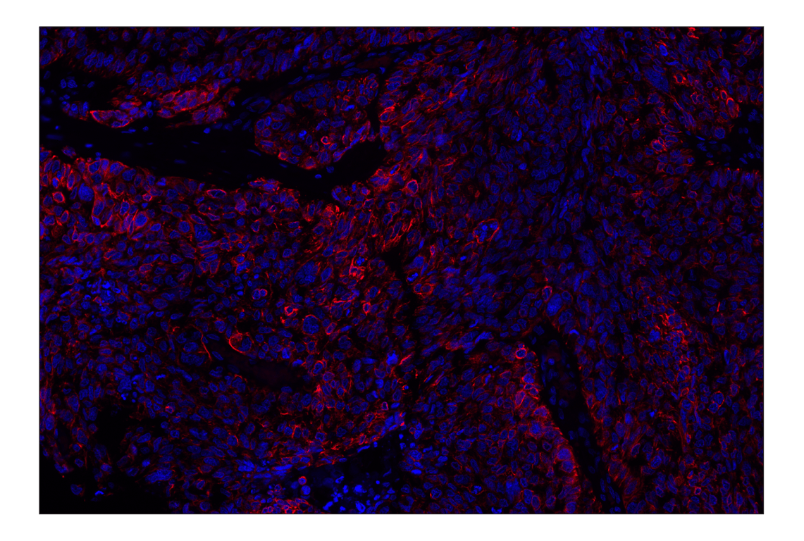 Immunohistochemistry Image 2: Keratin 5 (E2T4B) Rabbit Monoclonal Antibody (Alexa Fluor<sup>®</sup> 555 Conjugate)