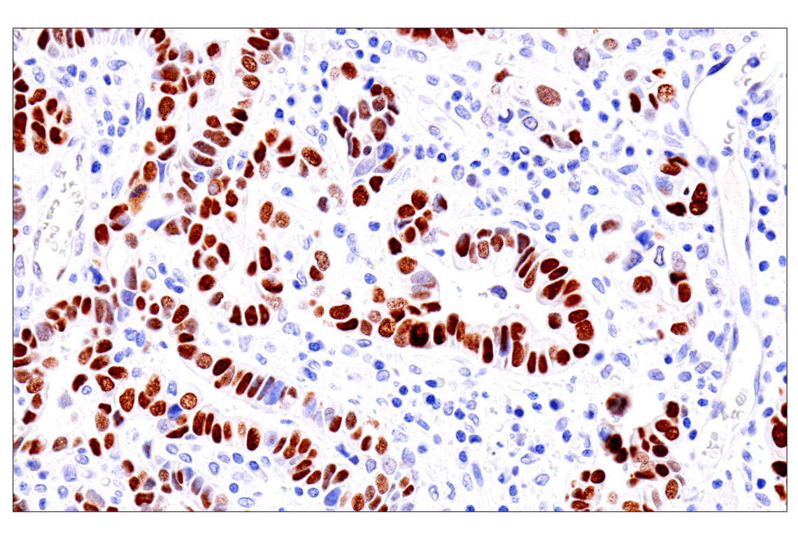 Immunohistochemistry Image 1: GATA-6 (D61E4) Rabbit Monoclonal Antibody