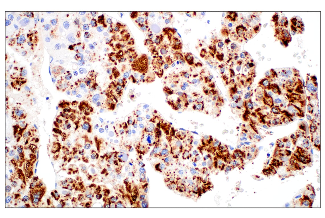 Immunohistochemistry Image 6: Perilipin-2 (E6G6M) Rabbit Monoclonal Antibody