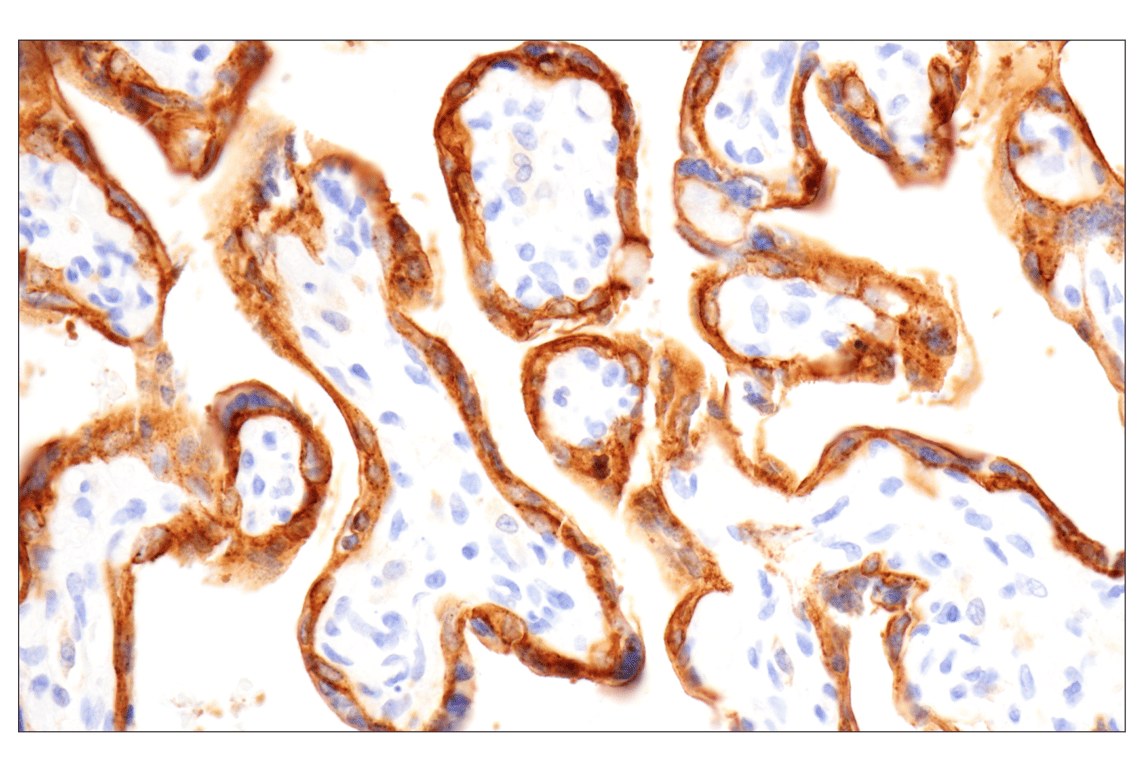 Immunohistochemistry Image 2: Angiomotin (F7W8U) Rabbit Monoclonal Antibody