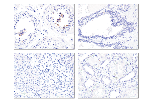 Immunohistochemistry Image 3: LIN28A (D84C11) Rabbit Monoclonal Antibody