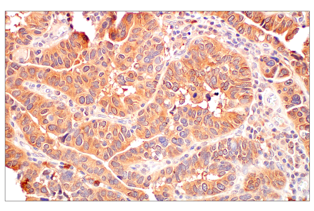 undefined Image 10: Gluconeogenesis Antibody Sampler Kit