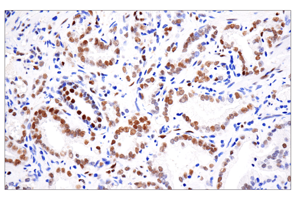 Immunohistochemistry Image 1: Phospho-Stat3 (Tyr705) (D3A7) XP<sup>®</sup> Rabbit mAb (BSA and Azide Free)