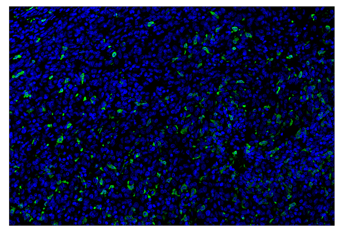 Immunohistochemistry Image 1: S100A9 (D5O6O) & CO-0180-647 SignalStar<sup>®</sup> Oligo-Antibody Pair