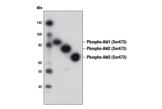 Western Blotting Image 2: Phospho-Akt (Ser473) (D9W9U) Mouse mAb