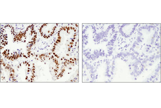 Immunohistochemistry Image 2: ANP32A (D7Z5U) Rabbit Monoclonal Antibody