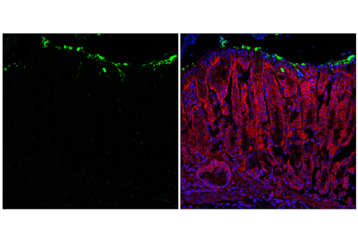 Immunofluorescence Image 2: MUC5AC (E9V1O) Rabbit Monoclonal Antibody