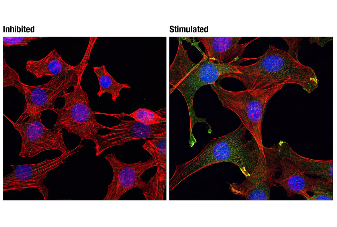 Immunofluorescence Image 1: Phospho-Akt (Ser473) (193H12) Rabbit mAb