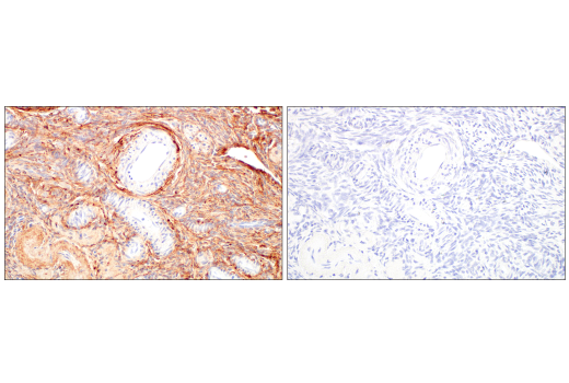 Immunohistochemistry Image 9: COL14A1 (E5W8S) Rabbit Monoclonal Antibody (BSA and Azide Free)
