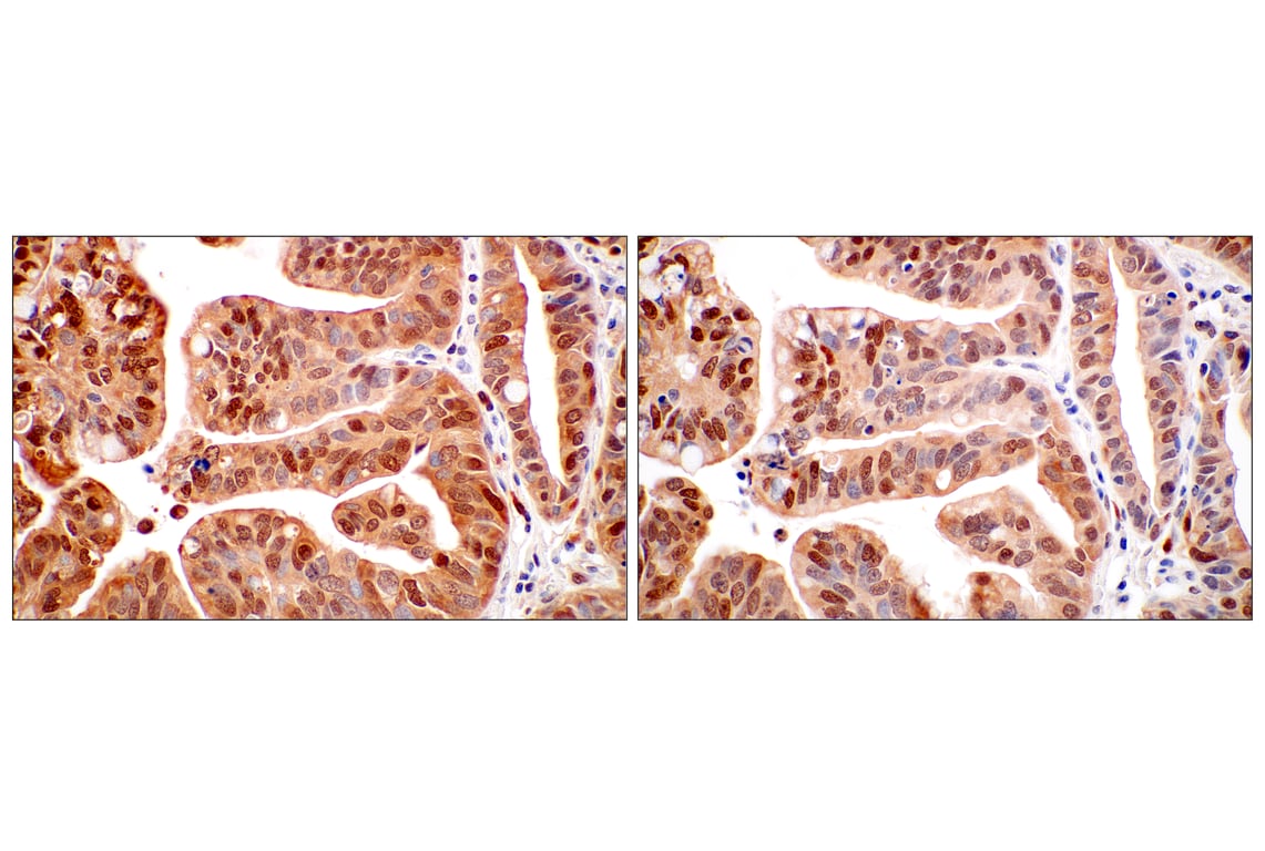 Immunohistochemistry Image 8: SerpinB1 (E4W7B) Rabbit Monoclonal Antibody