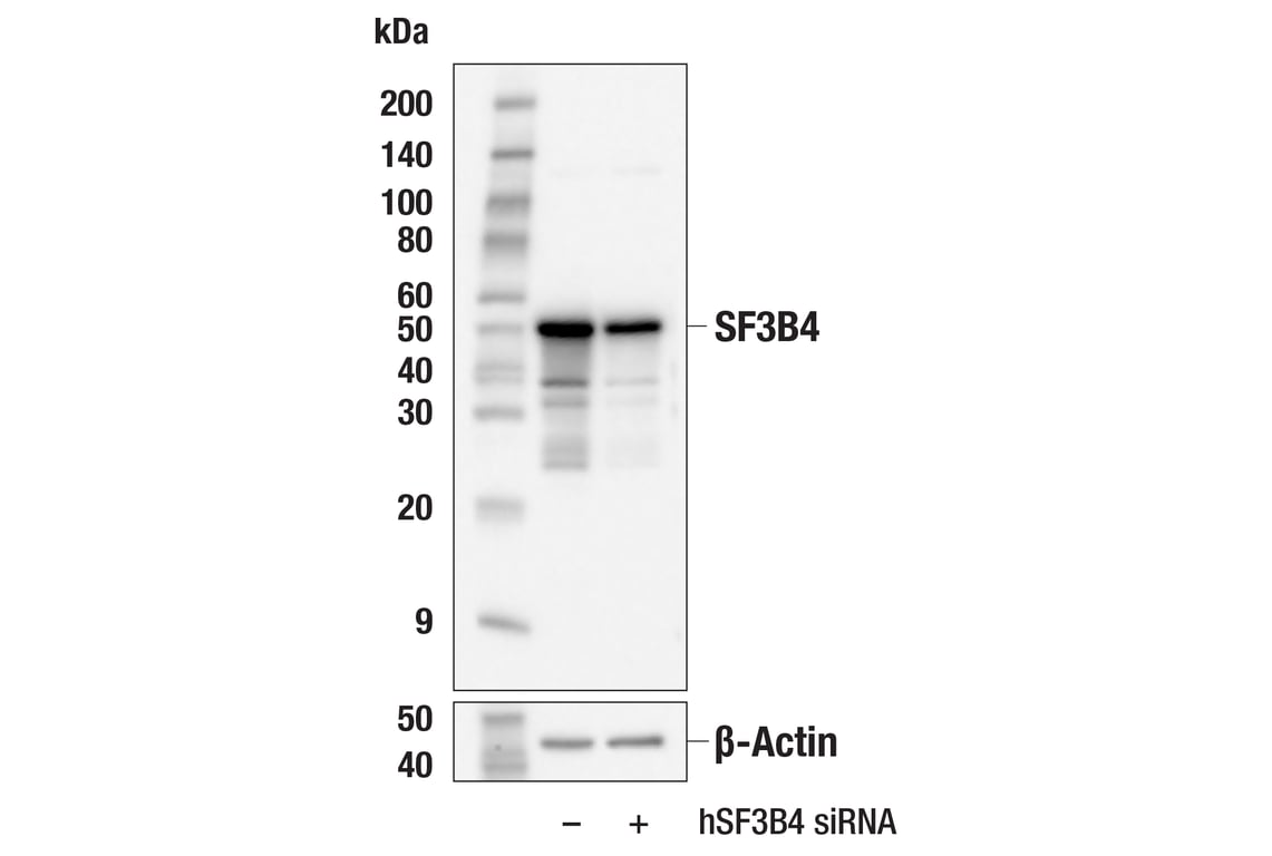 Western Blotting Image 2: SF3B4 (E7R4H) Rabbit Monoclonal Antibody