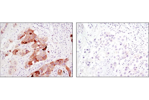 Immunohistochemistry Image 1: Phospho-Stathmin (Ser38) (D19H10) Rabbit Monoclonal Antibody