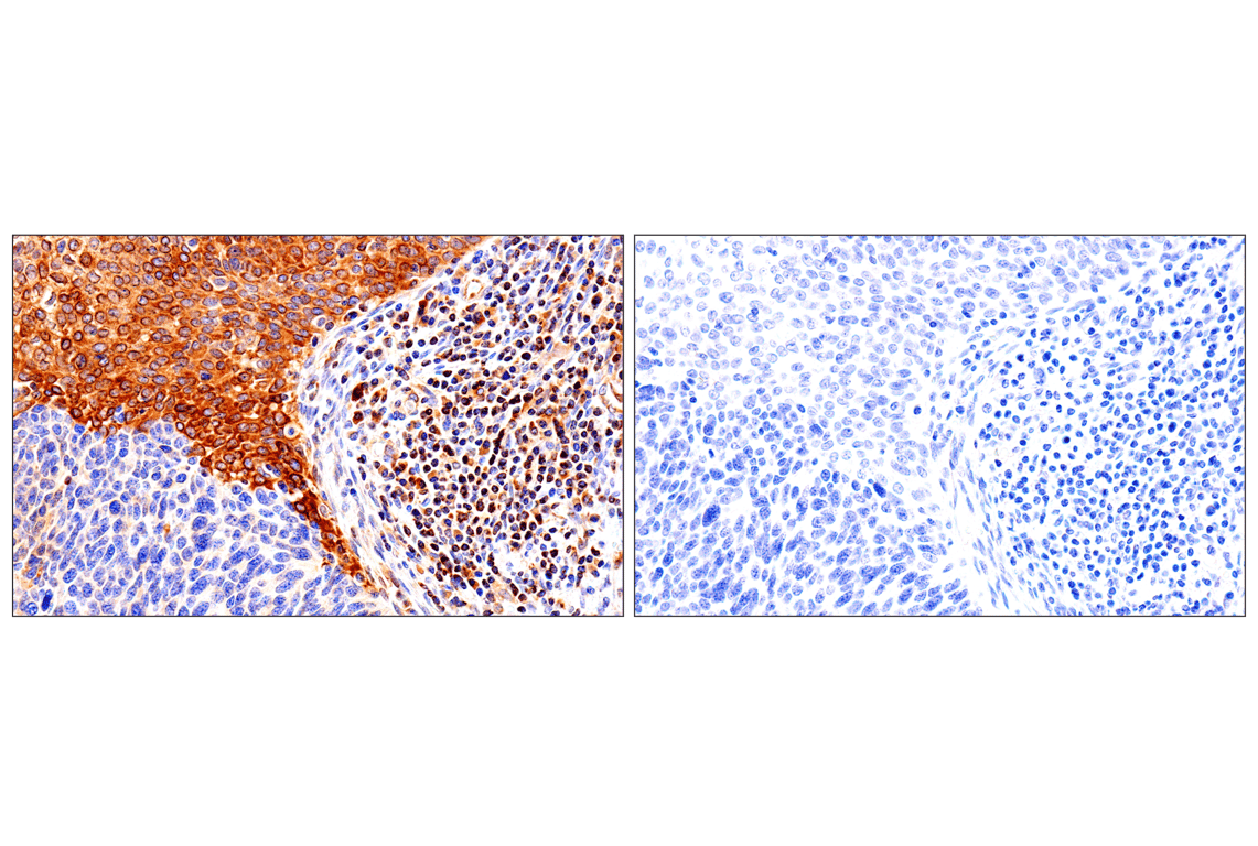 HLA-E (MEM-E/02) Mouse mAb (#73269) Datasheet With Images